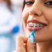 5 Foods To Avoid While Wearing Invisalign